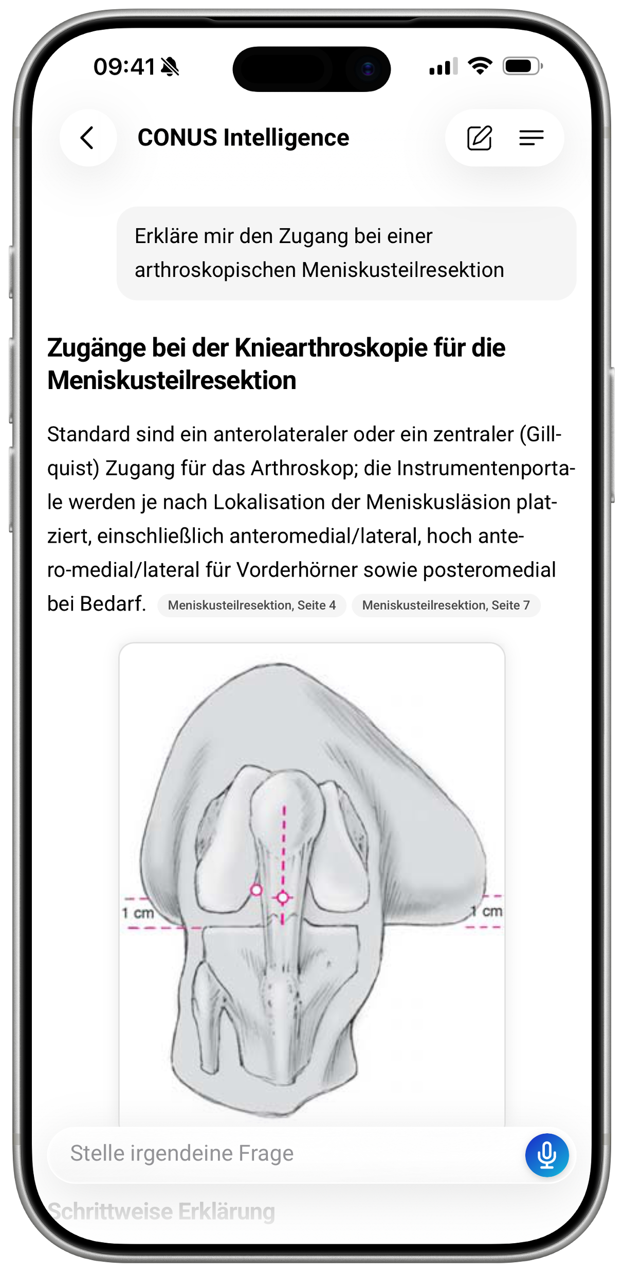 CONUS App auf dem Smartphone