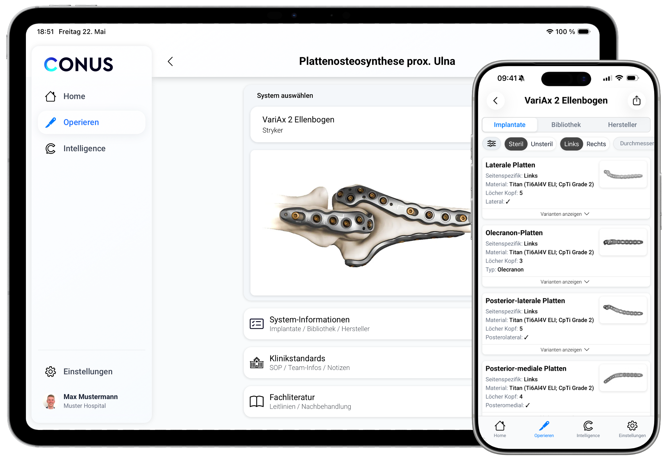 CONUS App auf iPad und iPhone