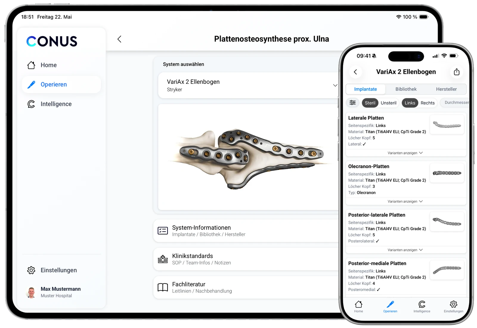 CONUS App auf iPad und iPhone